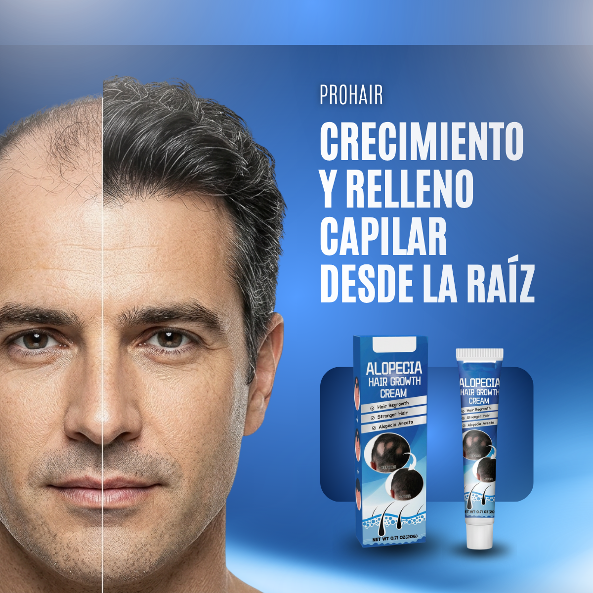 ProHair - Compre 1 Llevate 2 GRATIS 🎁