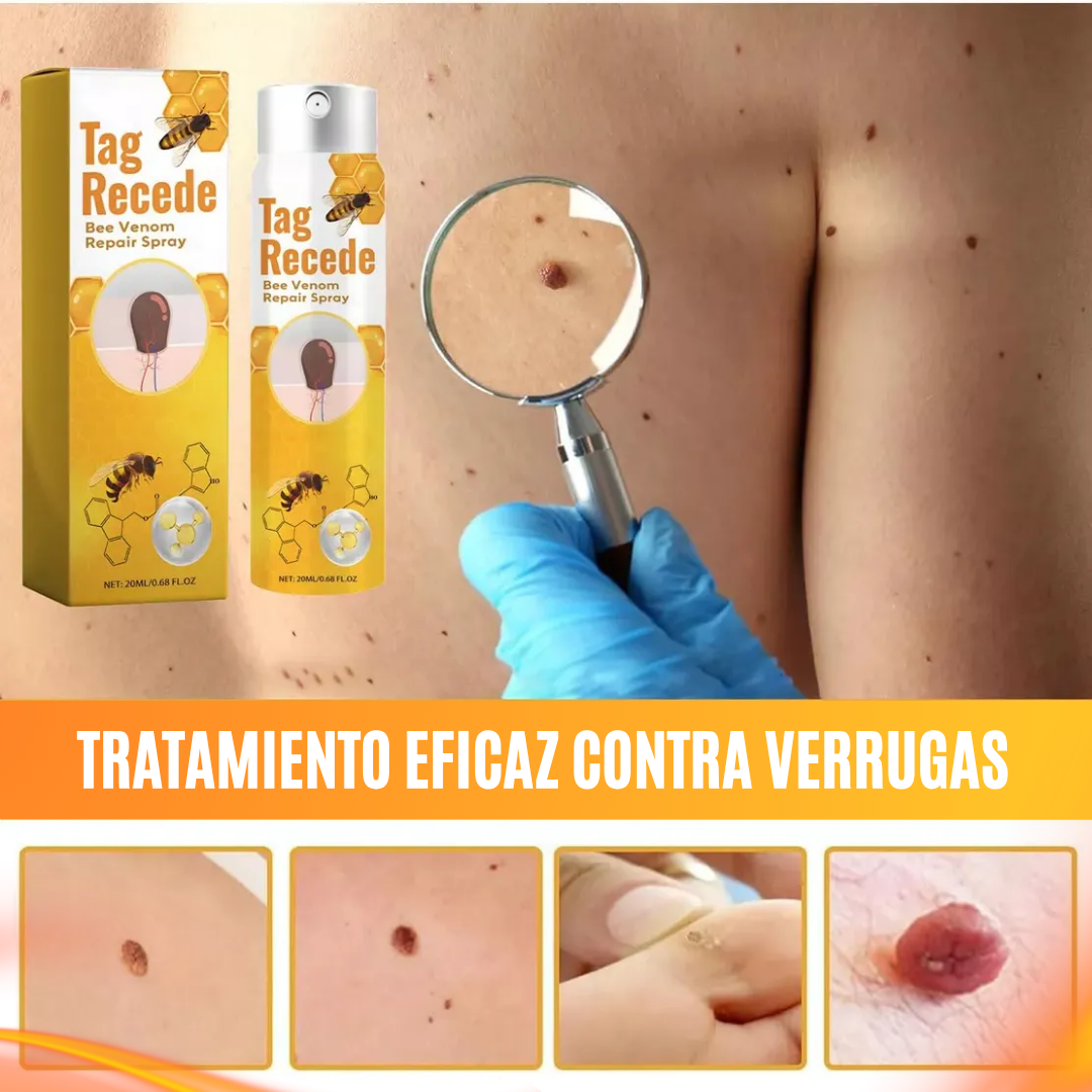 Tag Recede - Spray Elimina Verrugas Tag Recede - Spray Elimina Verrugas