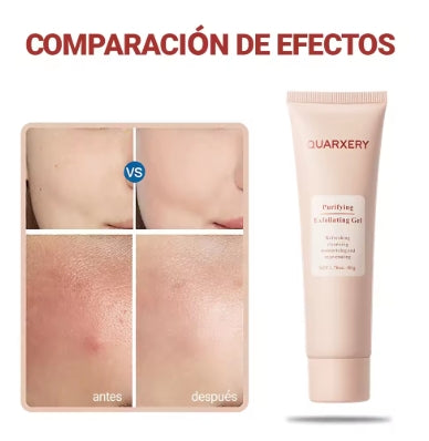 QUARXERY Gel Exfoliante Facial Limpiador Hidratante con Nicotinamida - Paga 1 y llévate 2
