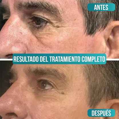 Sadoer Men - Recupera Una Piel Más Joven, Firme y Luminosa en Días