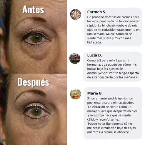 YCZ™ EyeLift Pro — Reduce Bolsas y Rejuvenece tu Mirada