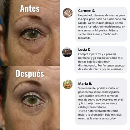 YCZ™ EyeLift Pro — Reduce Bolsas y Rejuvenece tu Mirada