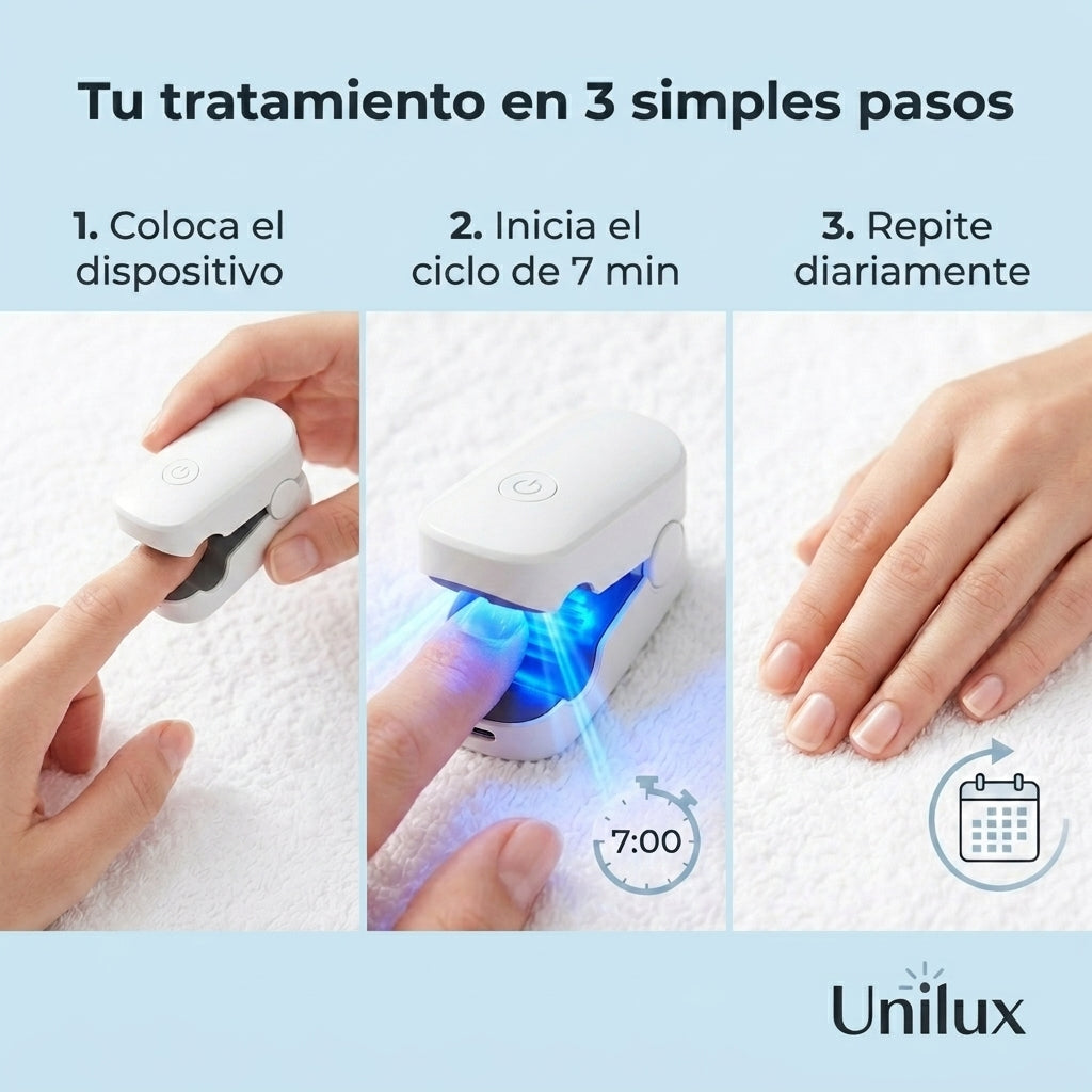 Unilux® - Dispositivo láser para tratamiento de hongos en las uñas